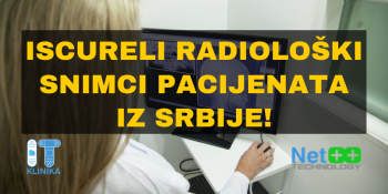 Iscureli radiološki snimci pacijenata iz Srbije!